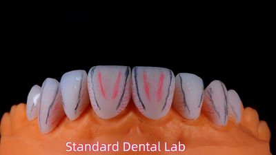 Standard Dental Lab Co., Limited निर्माता उत्पादन लाइन