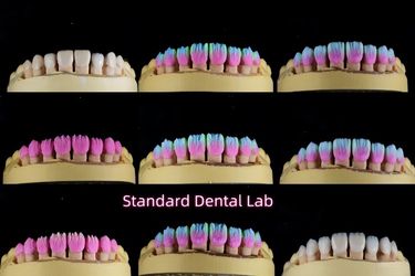 Standard Dental Lab Co., Limited निर्माता उत्पादन लाइन