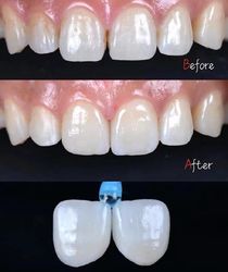 Standard Dental Lab Co., Limited निर्माता उत्पादन लाइन
