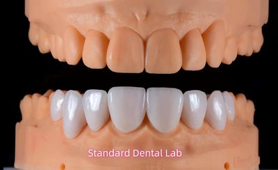 Standard Dental Lab Co., Limited निर्माता उत्पादन लाइन