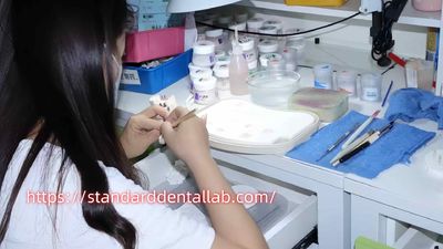 Standard Dental Lab Co., Limited निर्माता उत्पादन लाइन