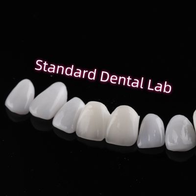 खरीदें घर्षण प्रतिरोधी Emax Zirconia Laminate Veneers Incisal Translucency घर्षण प्रतिरोधी ऑनलाइन निर्माण