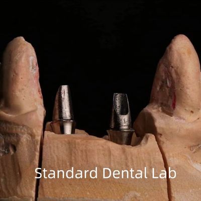 दंत चीनी मिट्टी Zirconia Implant Crown पेशेवर उच्च सौंदर्यशास्त्र