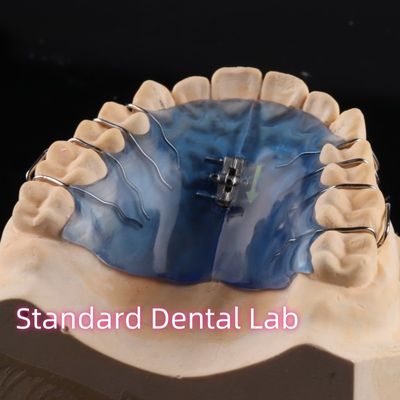 हटाने योग्य गला विस्तारक उपकरण मुखौटा के लिए ऑर्थोडॉन्टिक्स पेशेवर
