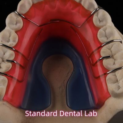 हटाने योग्य दंत Orthodontic उपकरण Hawley रिटेनर