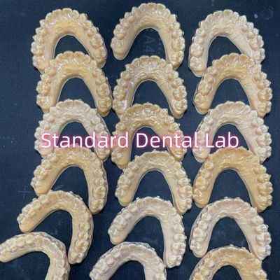 पेशेवर ऑर्थोडॉन्टिक इनविसालाइन क्लियर रिटेनर