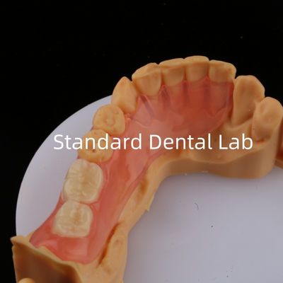 उच्च सौंदर्यशास्त्र के लिए एसी दांत गुलाबी/गहरे टीसीएस वालप्लास्ट लचीले आंशिक दांतों के लिए दंत 3 डी प्रिंट मॉडल