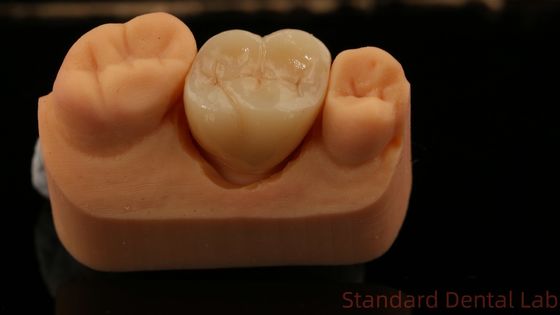 मिल और केंद्र पूर्ण Zirconia मुकुट, चीन दंत चिकित्सा प्रयोगशाला तेजी से वितरण