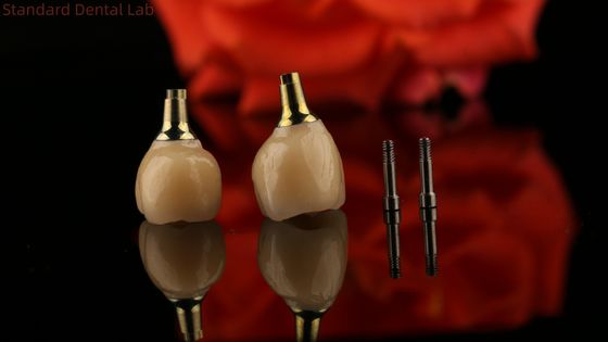 कस्टम फिट सौंदर्यशास्त्र के लिए पोर्सिलेन जिरकोनिया सीमेंट रिटेन स्क्रू इम्प्लांट हेक्सागोनल सिर आकार