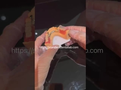 उच्च सौंदर्यशास्त्र स्पष्ट क्लैप और एक्रिलिक दांतों के साथ एक्रिलिक आंशिक प्रोटेट चीन दंत चिकित्सा प्रयोगशाला