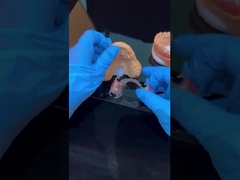 स्पष्ट ढांचा एक्रिलिक धातु आंशिक दांत ढांचे उच्च सौंदर्यशास्त्र चीन दंत चिकित्सा प्रयोगशाला