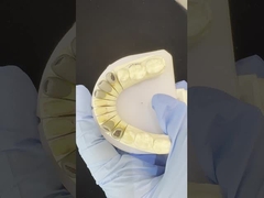 धातु कास्ट पोस्ट कोर क्राउन कोकर सटीक रिटेंटिव फुल जिरकोनिया ब्रूक्सियर