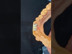 दंत दंत पीएफएम मैरीलैंड ब्रिज उच्च सौंदर्यशास्त्र एफडीए प्रमाणित