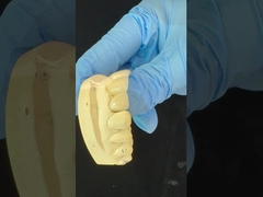 पूर्ण समोच्च जिरकोनिया मुकुट/उच्च सौंदर्य प्राकृतिक अनुकूलित एडिट जिरकोनिया दंत पुल