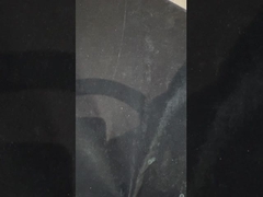 टाइटेनियम प्रत्यारोपण समर्थित दांत प्रत्यारोपण पर सटीक इवोक्लर दांत