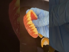 पूर्ण ऊपरी और निचले स्टेपप्लेट एक्रिलिक आंशिक दांतों Ivoclar दांत गुलाबी गम