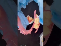 थ्रीडी प्रिंट मॉडल उच्च सौंदर्यशास्त्र दंत चिकित्सा टीसीएस वालप्लास्ट लचीला आंशिक दांतों दंत चिकित्सा प्रयोगशाला